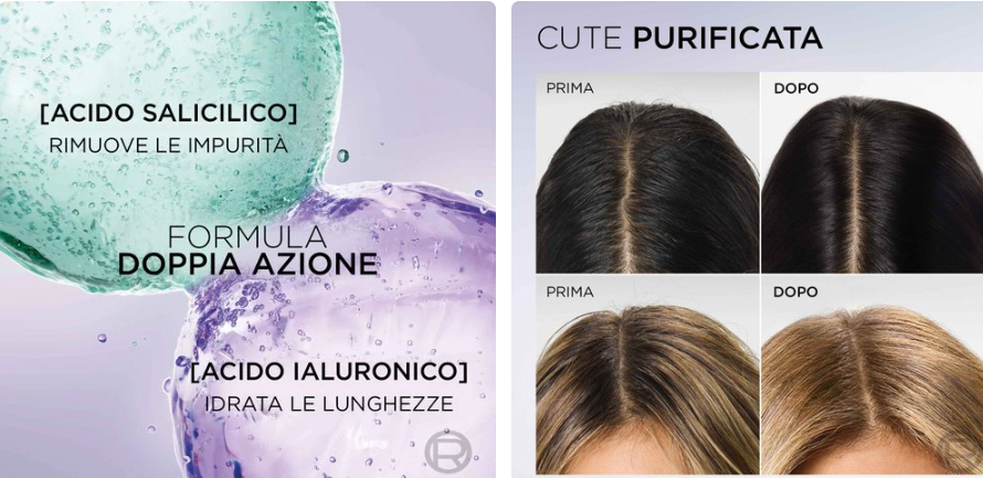 L'Oréal Elvive Shampoo Hyaluronic Pure – Formato Maxi 700ml – Acido Salicilico Purificante e Acido Ialuronico Idratante – Per Cute Grassa e Punte Secche