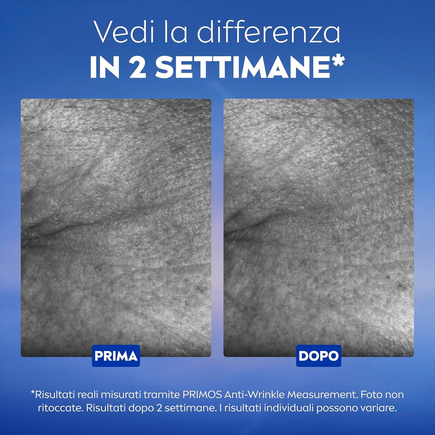 NIVEA Cellular Epigenetics Siero Ringiovanente 30ml – Con Epicelline e 3 Tipi di Acido Ialuronico – Tecnologia Brevettata Age Clock